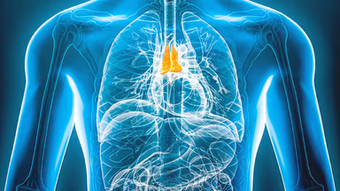 Tìm hiểu nguyên nhân mắc u lympho trung thất