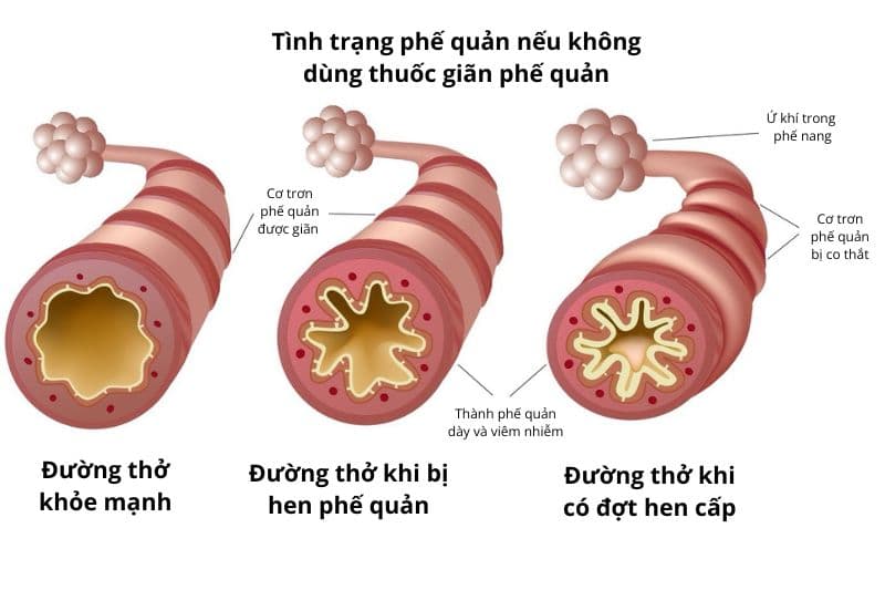 tác dụng của thuốc giãn phế quản