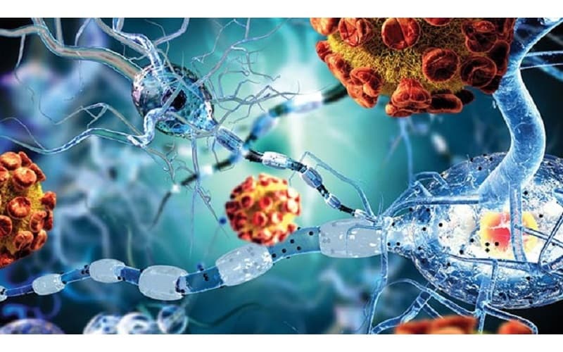 Áp xe phổi là tình trạng hình thành các ổ mủ trong mô phổi, thường do vi khuẩn xâm nhập gây nhiễm trùng