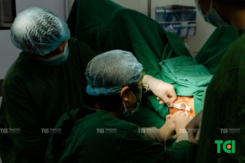 Cận cảnh 1 ca đốt trĩ Laser Diode tại TCI