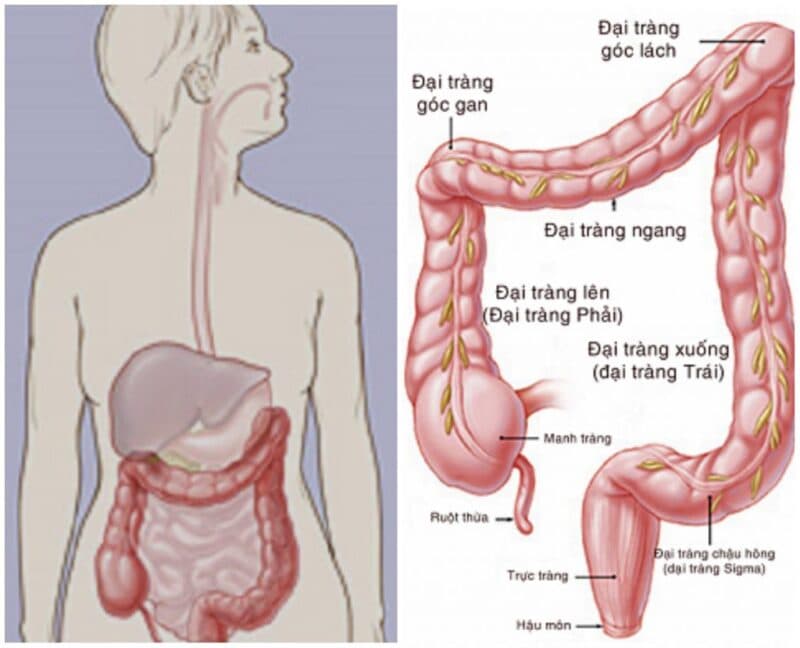 Viêm đại tràng ở nữ khá phổ biến.