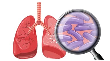 Yếu tố ảnh hưởng tới bệnh lao có chữa được không