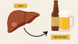 Bệnh gan do rượu: Cơ chế và cách phòng tránh hiệu quả