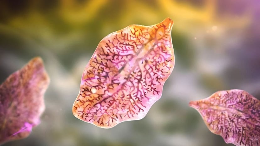 Bệnh sán lá gan là gì? Nguyên nhân và dấu hiệu nhận diện