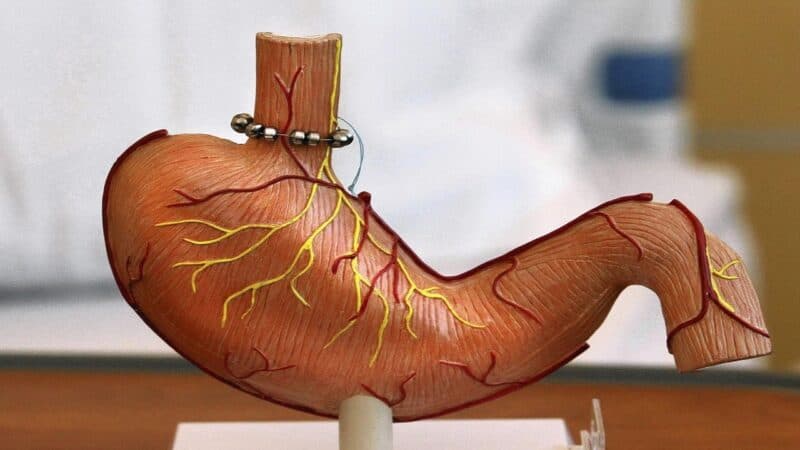 Chế độ ăn cho người trào ngược dạ dày