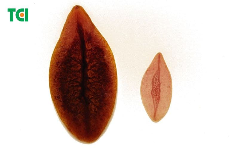 Dấu hiệu sán lá gan lớn và nhỏ