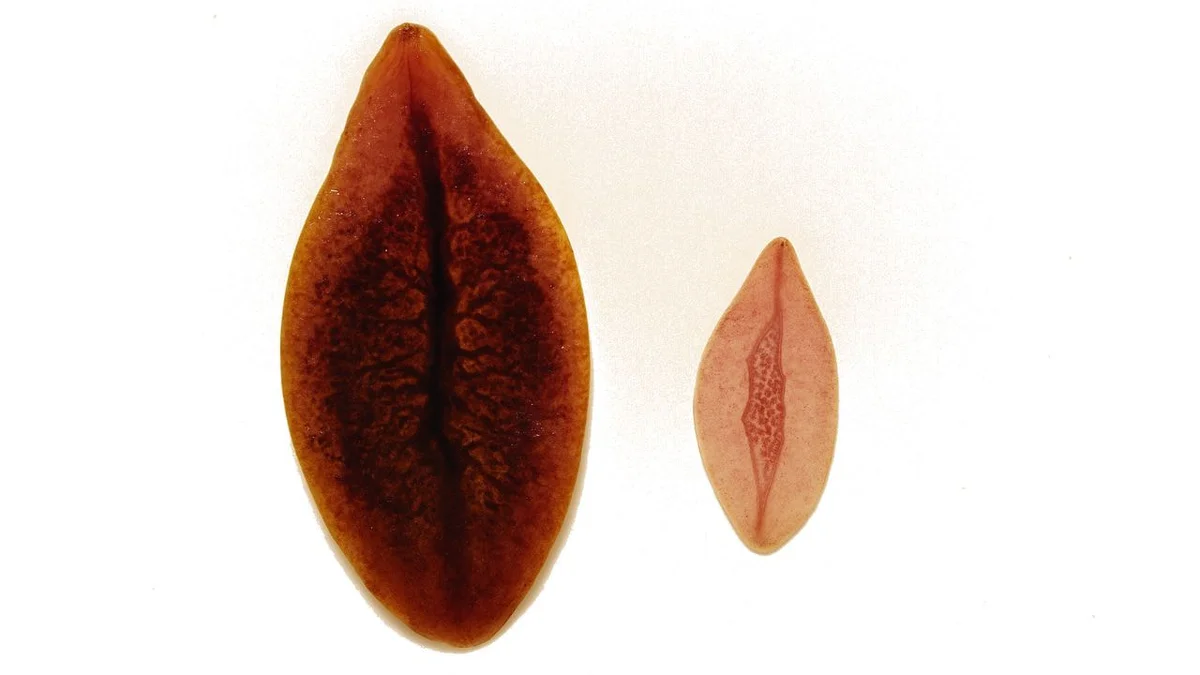 Dấu hiệu sán lá gan trú ngụ trong cơ thể và cách kiểm soát