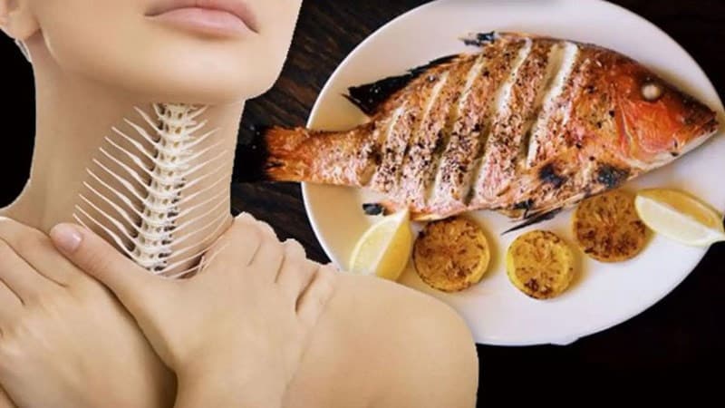 Cách điều trị hóc xương cá như thế nào tối ưu nhất