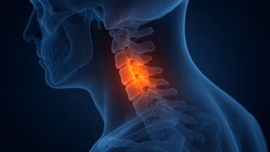 Hướng dẫn điều trị cổ vai gáy không phẫu thuật