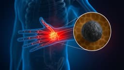 Nhận biết sớm dấu hiệu của ung thư xương để bảo vệ sức khỏe