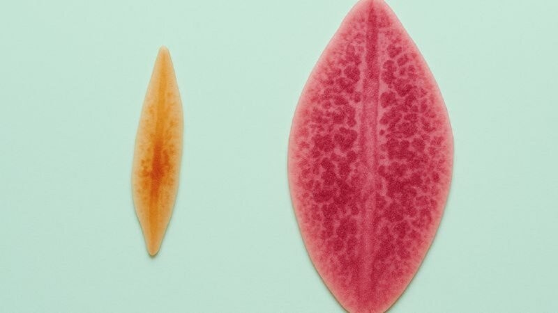 triệu chứng sán lá gan