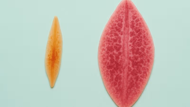 triệu chứng sán lá gan