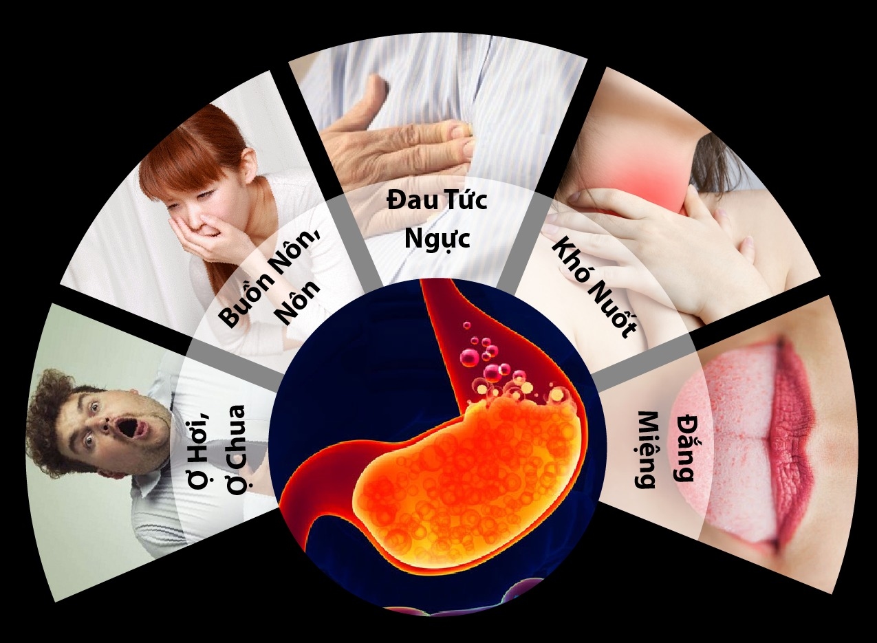 Đau bao tử gây ra nhiều triệu chứng khó chịu