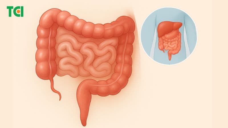 Đau ruột thừa là bệnh lý ngoại khoa cấp cứu phổ biến