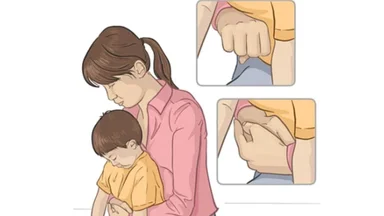 Cách sơ cứu trẻ bị hóc dị vật đảm bảo an toàn tuyệt đối