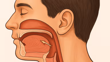 Cách xử lý khi bị hóc xương cá nhỏ tại nhà và khi nào cần bác sĩ