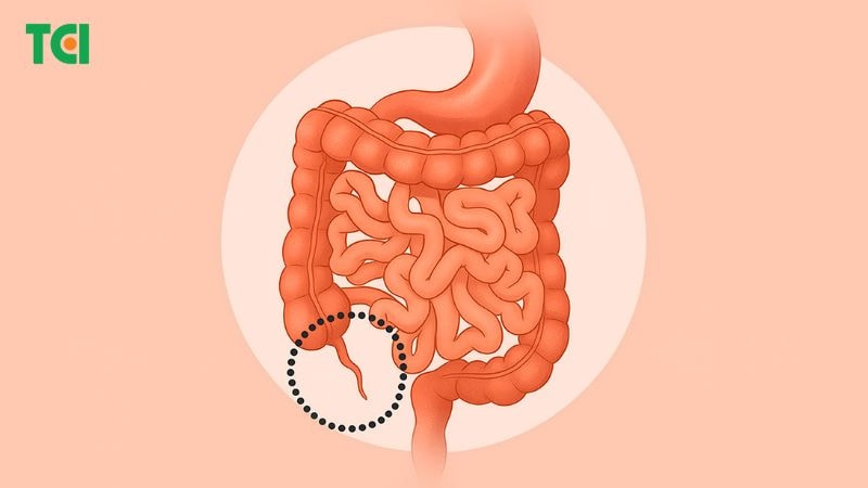 Vị trí ruột thừa trong hệ tiêu hóa của người