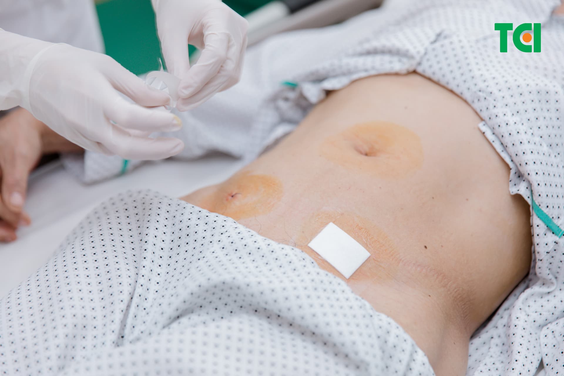 Những lưu ý khi lựa chọn phương pháp cắt ruột thừa