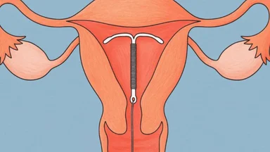 Hiểu đúng về việc đặt vòng tránh thai có gây tăng cân không