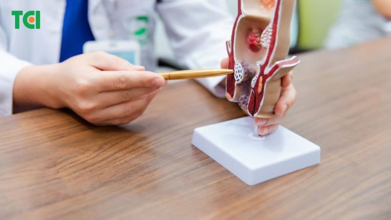 Cần thăm khám chuyên khoa và điều trị áp xe hậu môn cũng như các bệnh lý hậu môn trực tràng nói chung
