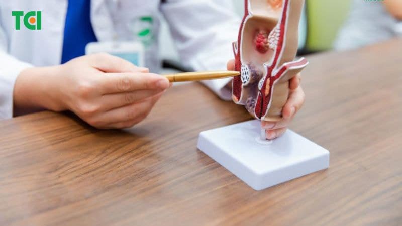 Cần thăm khám chuyên khoa và điều trị áp xe hậu môn cũng như các bệnh lý hậu môn trực tràng nói chung