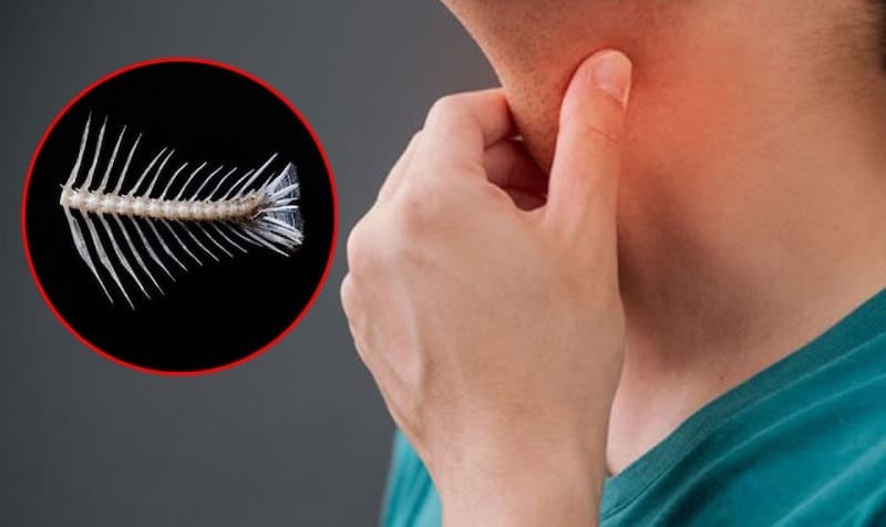 Cách chữa hóc xương ở cổ họng: Không nên áp dụng những cách khiến hóc xương trở nên nặng hơn