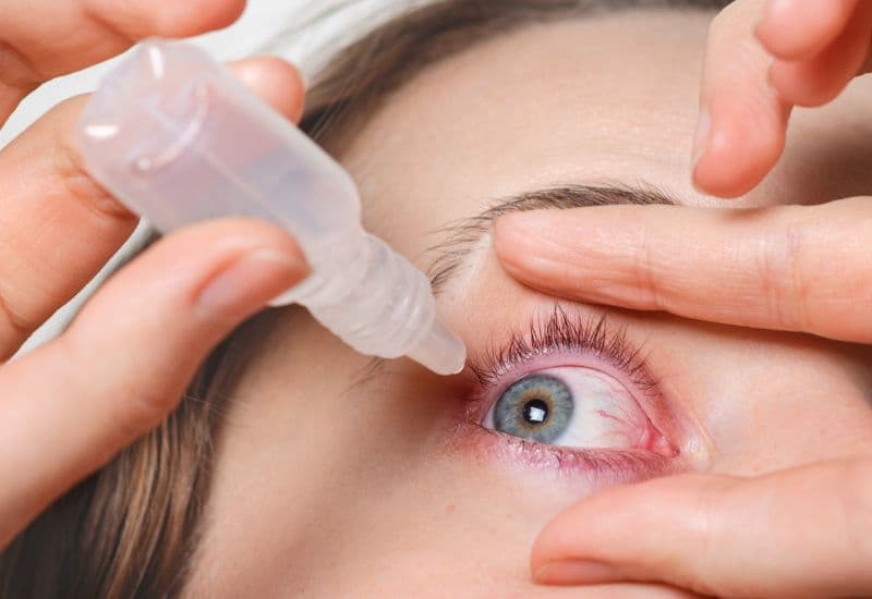 Cách xử lý tại nhà khi bị đau mắt đỏ