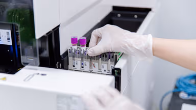 Các xét nghiệm cơ bản trong gói sàng lọc tiền hôn nhân nam và nữ