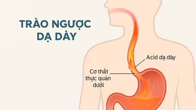 Cách ăn uống cho người bị trào ngược dạ dày hỗ trợ điều trị