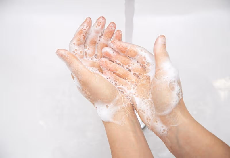 Mụn rộp ở môi - Giữ vệ sinh vùng miệng