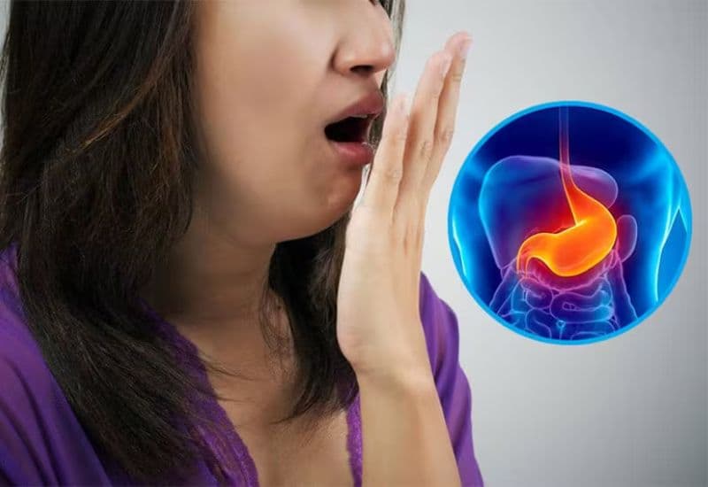 Nguyên nhân hôi miệng do bệnh lý y khoa