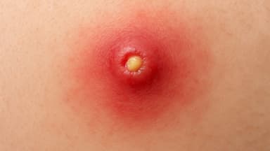 Áp xe: Nguyên nhân, dấu hiệu nhận biết và cách điều trị hiệu quả