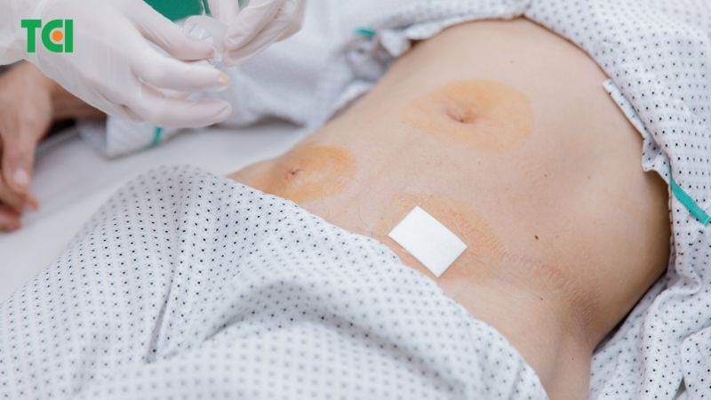 việc can thiệp bằng phẫu thuật nội soi giúp người bệnh hồi phục nhanh, giảm nguy cơ biến chứng và rút ngắn thời gian nằm viện.