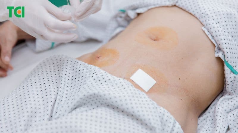 việc can thiệp bằng phẫu thuật nội soi giúp người bệnh hồi phục nhanh, giảm nguy cơ biến chứng và rút ngắn thời gian nằm viện.