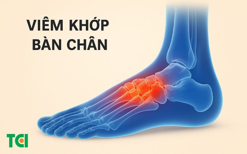 Các vị trí đau lòng bàn chân thường gặp