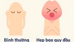Nguyên nhân hẹp bao quy đầu: Triệu chứng, phương pháp điều trị