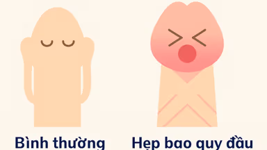Nguyên nhân hẹp bao quy đầu: Triệu chứng, phương pháp điều trị