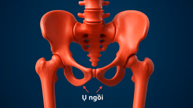 Ụ ngồi: Chức năng, bệnh lý thường gặp và cách điều trị hiệu quả