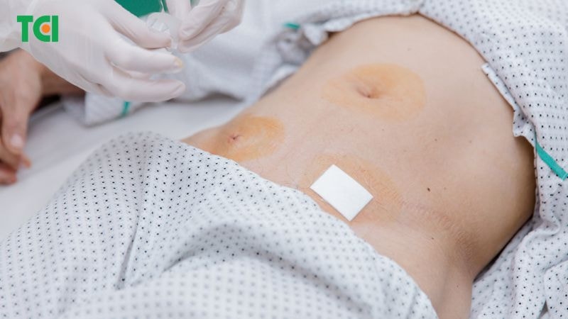 Phương pháp hiện đại, ít xâm lấn, giúp người bệnh hồi phục nhanh, giảm đau và hạn chế sẹo sau mổ