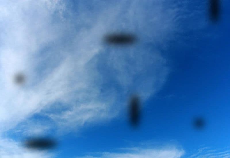 Cận nặng có bị mù không - Dấu hiệu cảnh báo sớm nguy cơ biến chứng ở người cận nặng