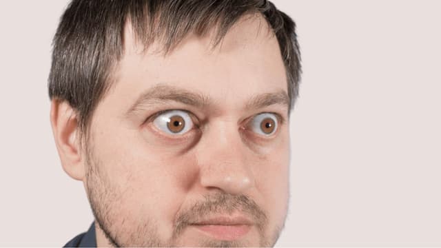 Mắt lồi nhẹ: Khi nào bạn cần thăm khám và can thiệp sớm