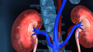 Bị sỏi thận có chữa khỏi hoàn toàn không?