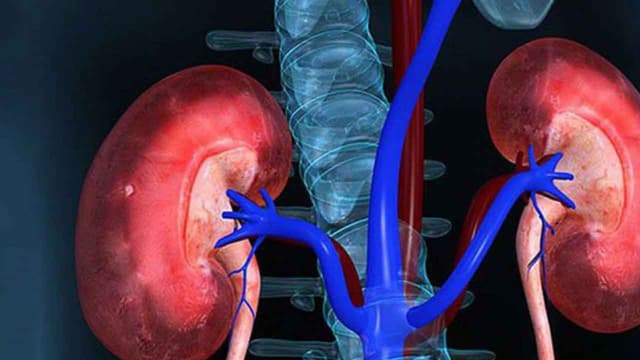 Bị sỏi thận có chữa khỏi hoàn toàn không?