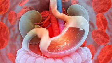 Chảy máu dạ dày có nguy hiểm không, phòng ngừa thế nào?