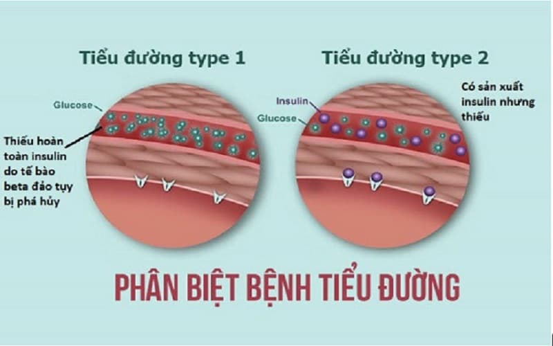 đái tháo đường không phụ thuộc insulin
