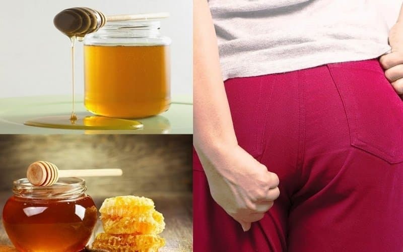 bệnh trĩ có uống được mật ong không