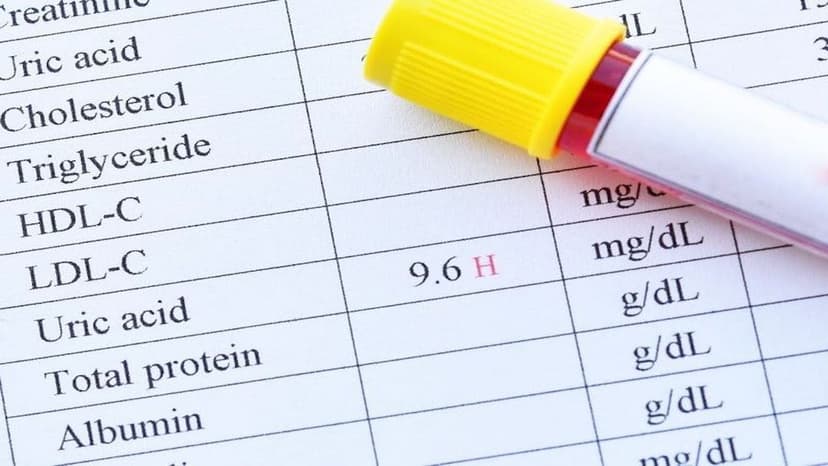 Chi tiết cách đọc chỉ số xét nghiệm máu sốt xuất huyết