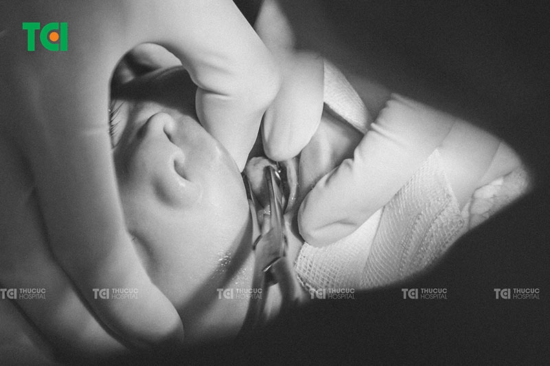 Bác sĩ Thu Cúc TCI kiểm tra vùng phẫu thuật sau khi cắt thắng lưỡi cho trẻ để đánh giá mức độ lành thương và đau nhẹ sau thủ thuật.