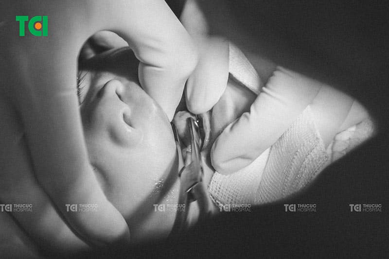 Bác sĩ Thu Cúc TCI kiểm tra vùng phẫu thuật sau khi cắt thắng lưỡi cho trẻ để đánh giá mức độ lành thương và đau nhẹ sau thủ thuật.