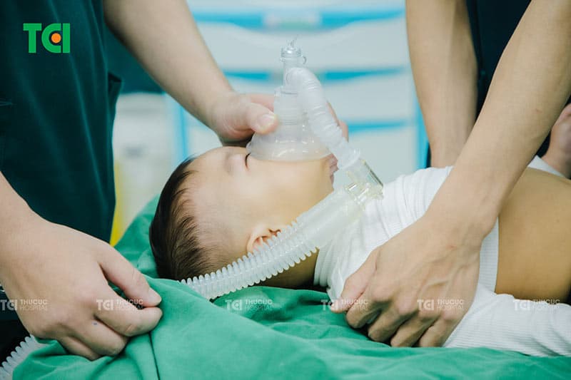 Trẻ được gây mê hô hấp trước khi cắt thắng lưỡi tại Thu Cúc TCI để đảm bảo an toàn và không gây đau.